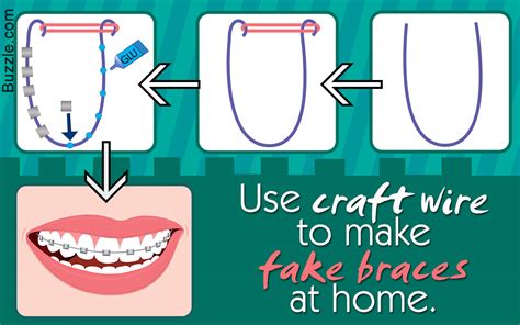 fake braces and headgear|can you make a brace.